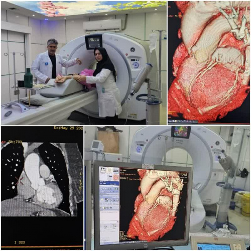 انجام اولین مورد سی تی اسکن آنژیوگرافی تاوی قلب در استان اردبیل